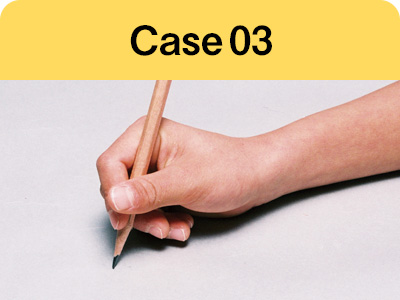 Case03