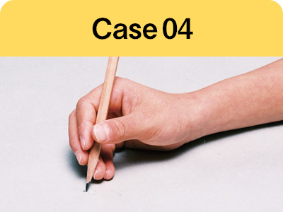 Case04